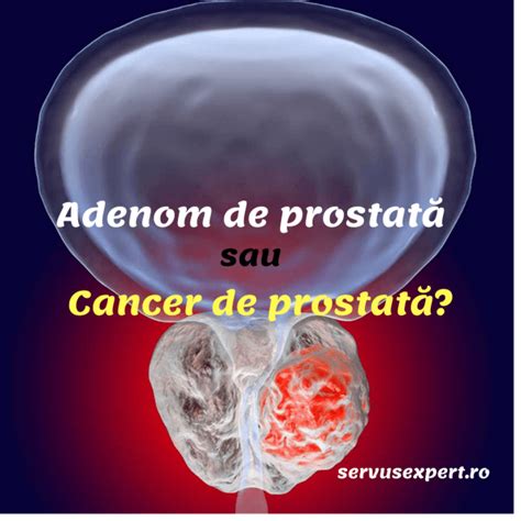 exemple de adenom de prostată